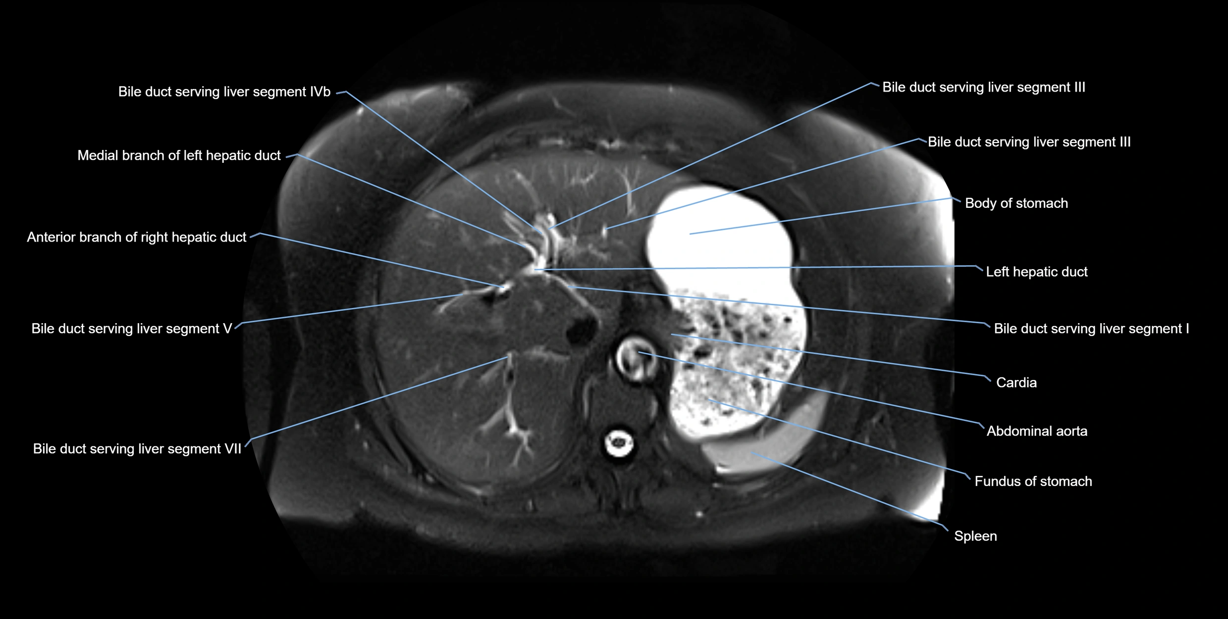MRI MRCP axial cross sectional anatomy 3T radiology  image-img-10001-00013.webp